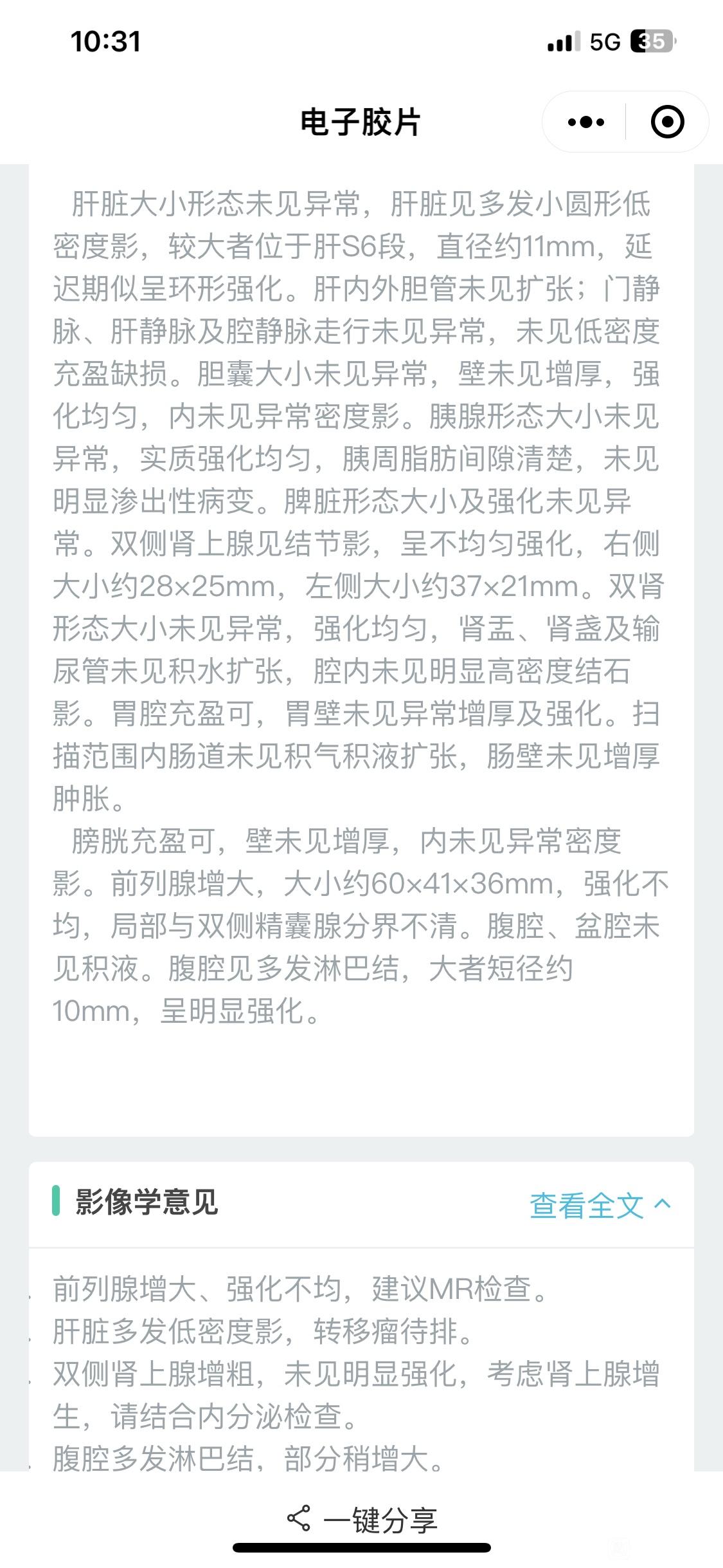 肝转移瘤待排